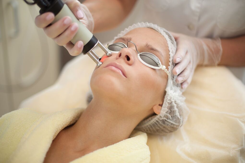 Laser renewal of the skin