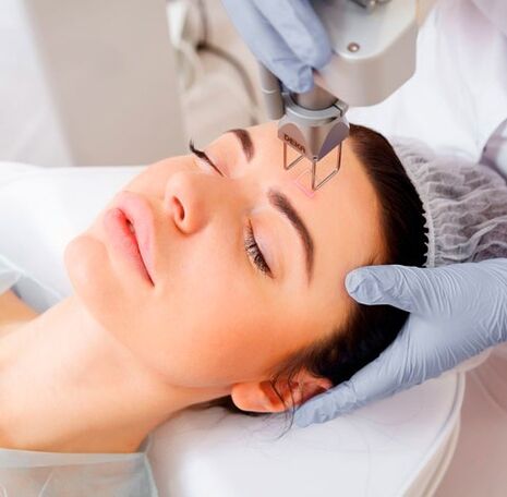 Laser renovation of the face