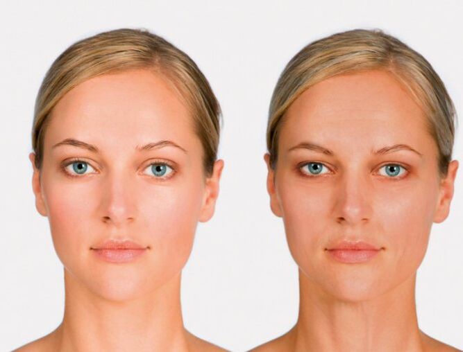 face after and before renovation